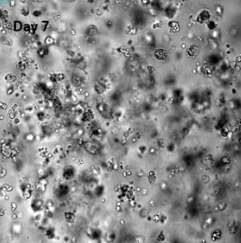 VitroGel YIGSRを用いた乳がん細胞（MCF-7）の三次元培養